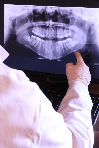 Best Emergency Dental Extractions in Kinnelon, NJ