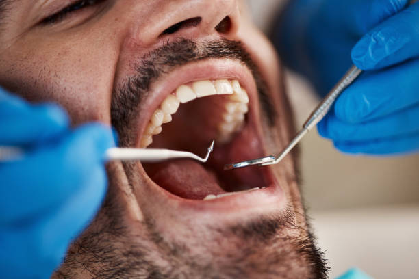 Best Emergency Dental Services for Seniors in Kinnelon, NJ